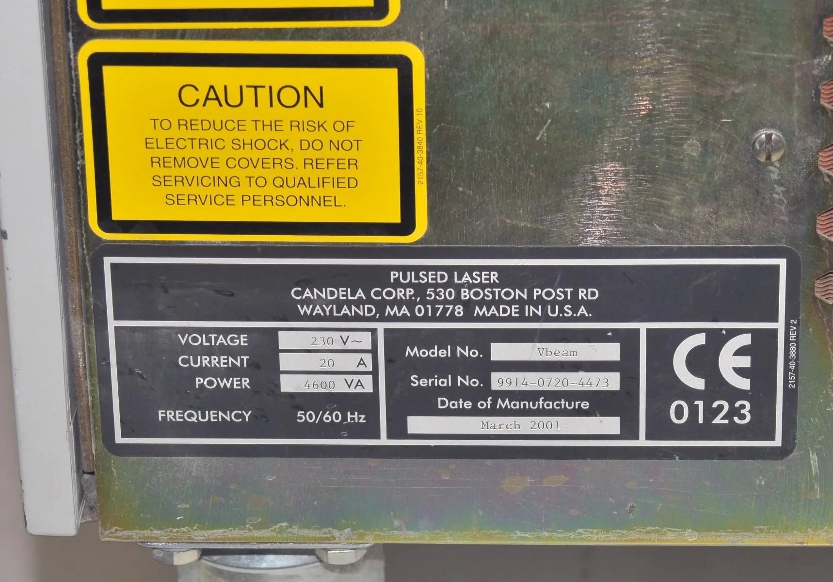 2001 Candela VBeam 595nm Laser Lesions Vascular Wrinkles Veins PDL Pulsed Dye