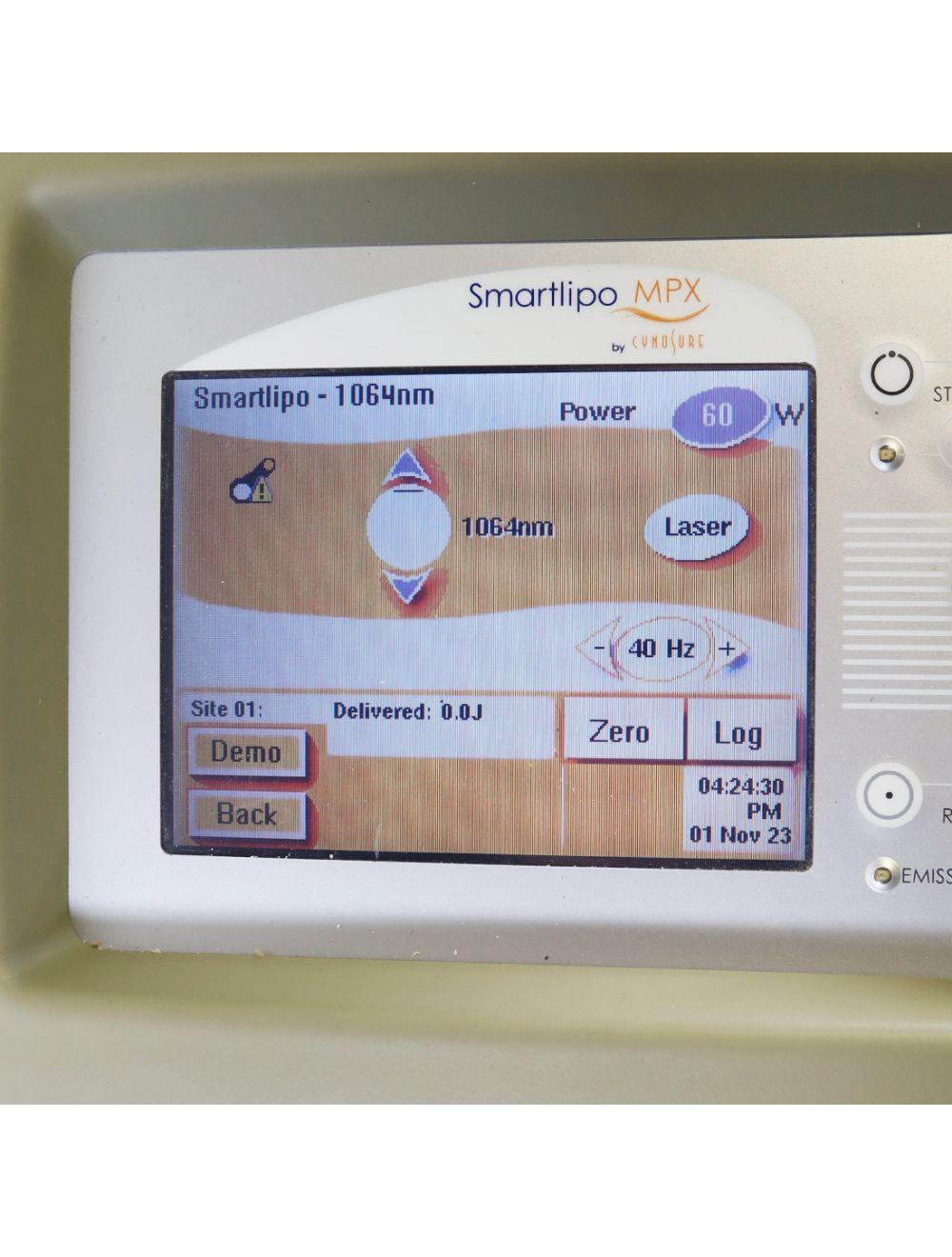 2008 Cynosure Smartlipo MPX 1064 1320 Nd YAG Laser BodySculpt Dual Wavelength