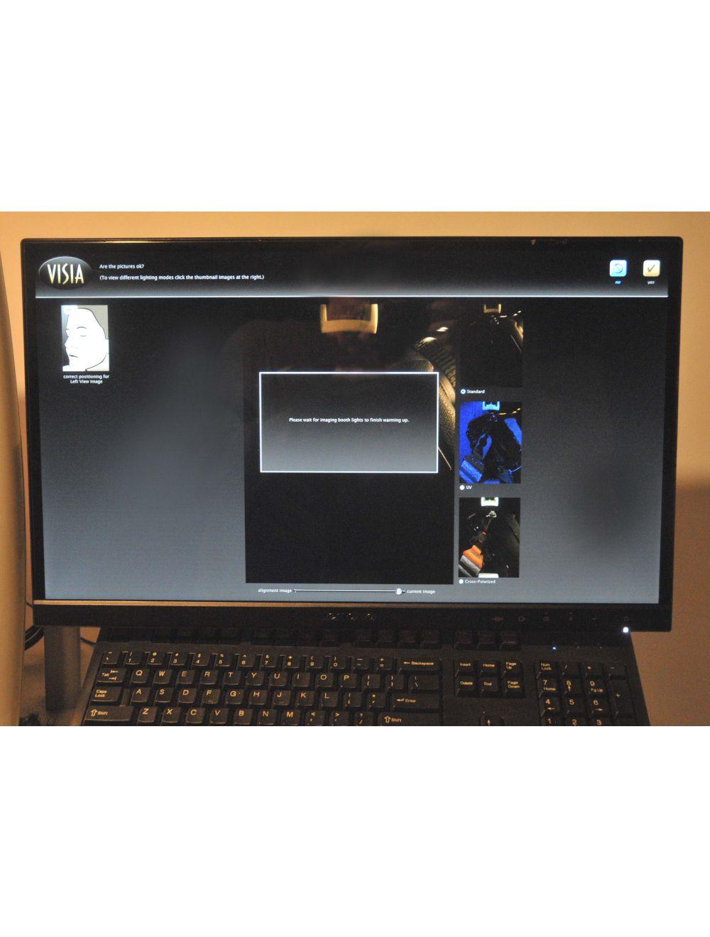 Canfield Scientific VISIA Facial Imaging System - Complexion Analysis Skin Care