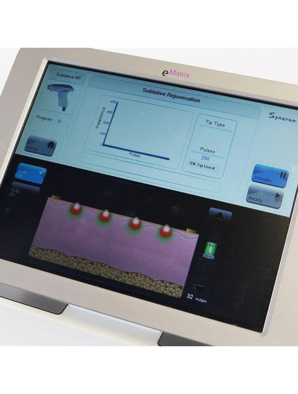 Syneron eMatrix Skin Rejuvenation TableTop Sublative RF System FG70442