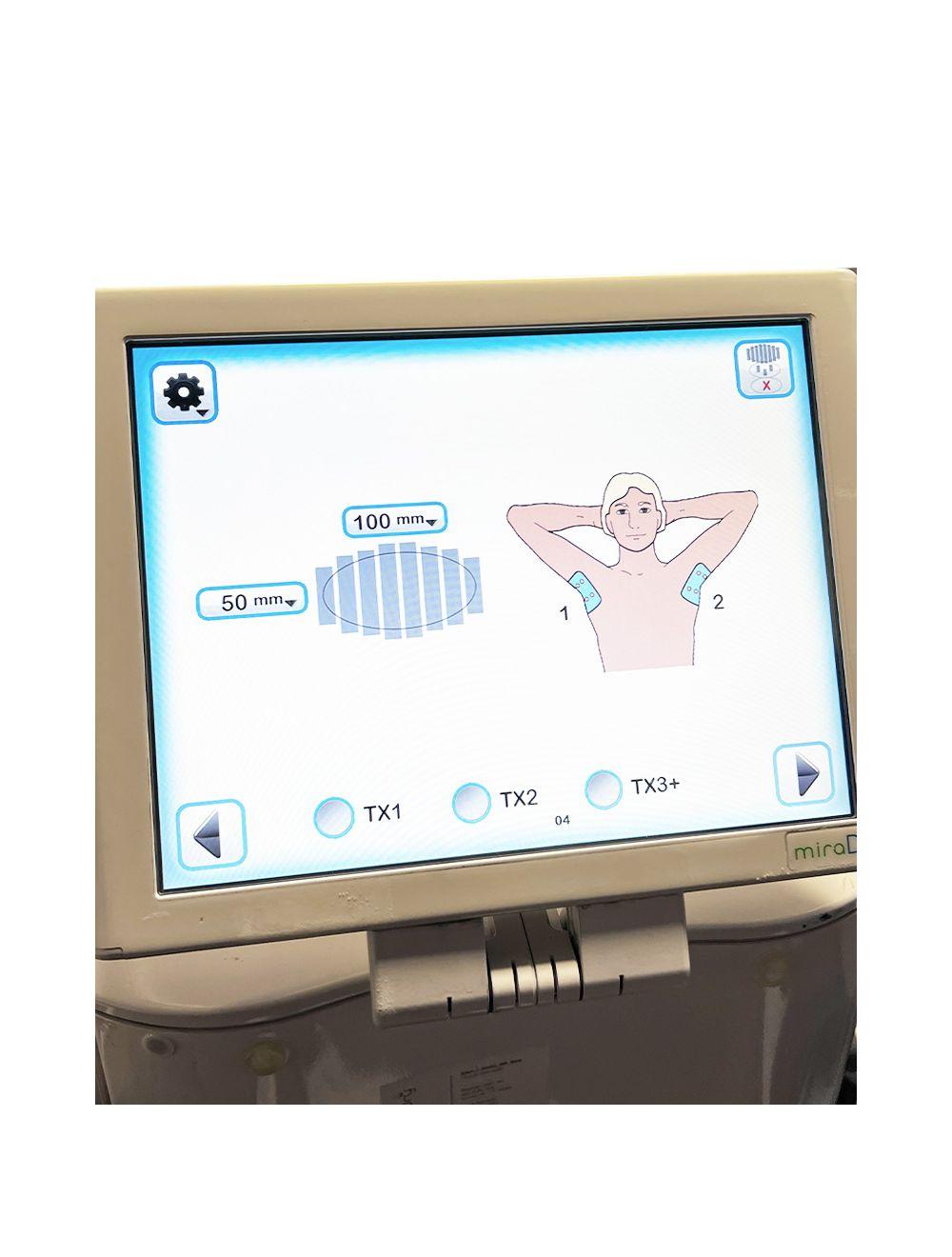 2012 Miramarlabs MiraDry MD4000-MC Sweat Odor Reduction Hyperhidrosis System