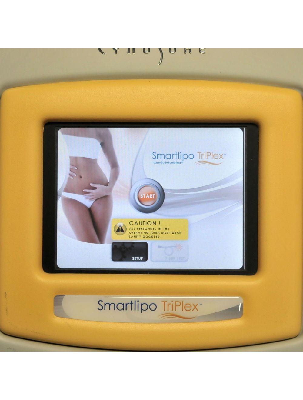 2014 Cynosure SmartLipo Triplex SLT II 1064 1320 1440 Laser Tri Plex Lipolysis
