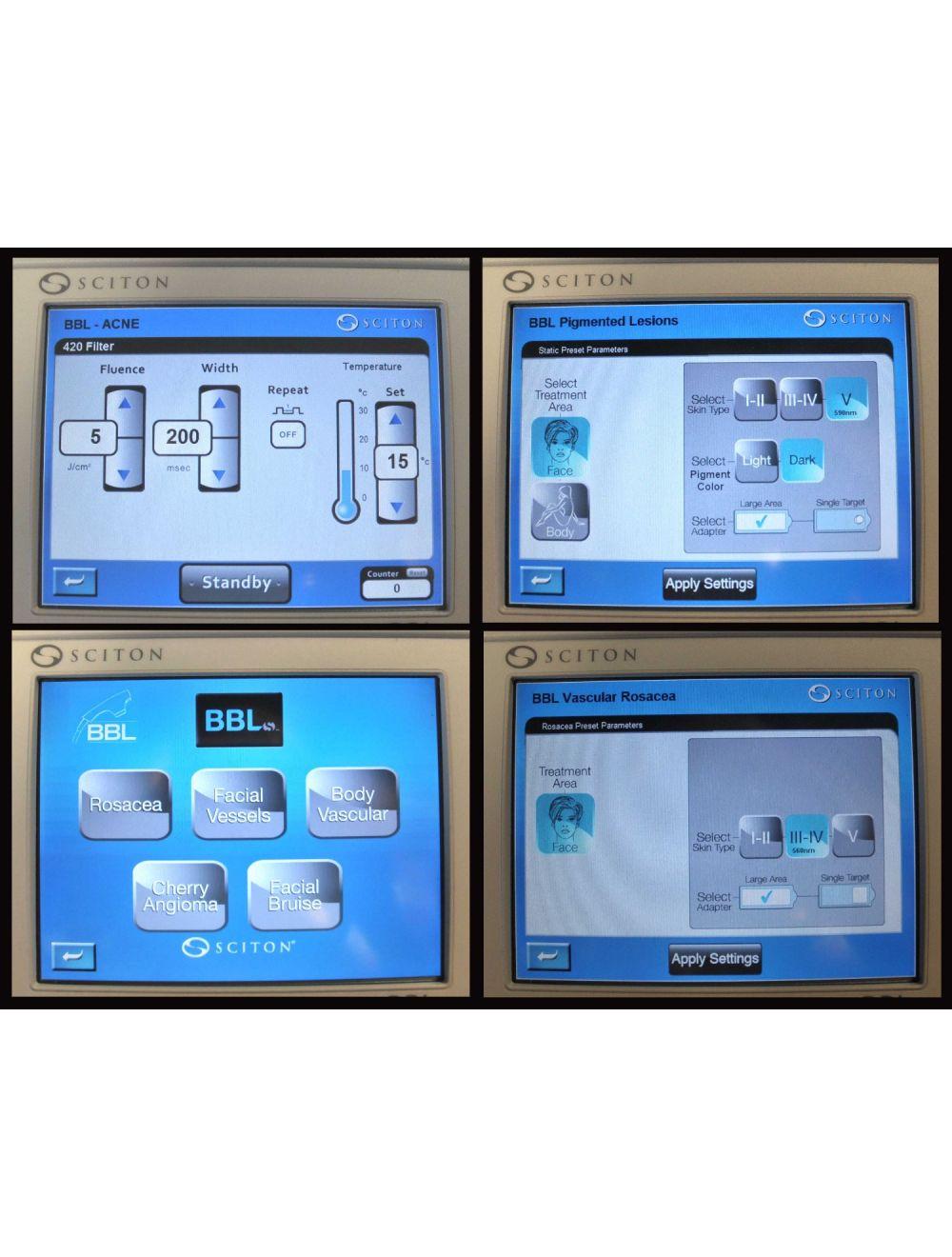 Sciton Profile BBLs Laser Broad Band Light Pigment Hair Removal Vascular Loaded