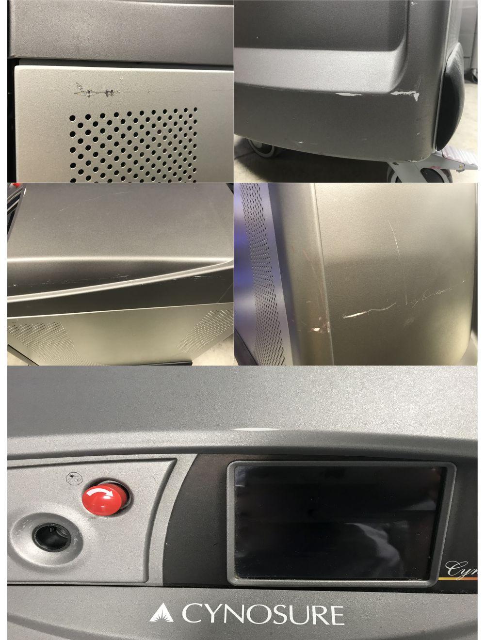 2006 Cynosure Cynergy Multiplex Pulsed Dye Nd YAG Laser Vascular Pigment Lesions