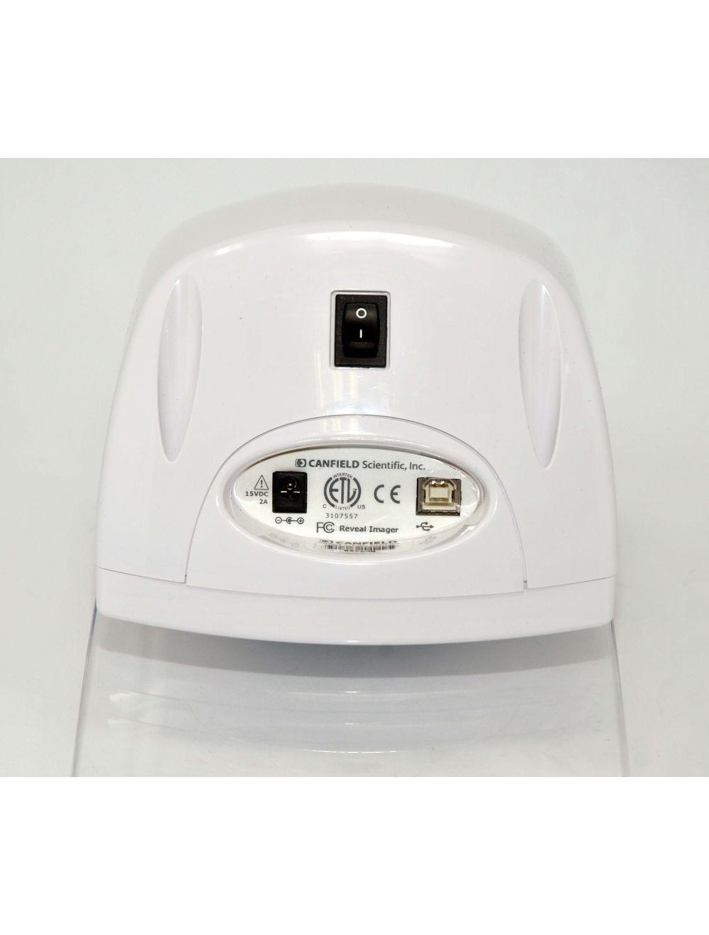 CANFIELD Reveal Imager Facial Imaging System Skin Treatment Photos Hi Res Image