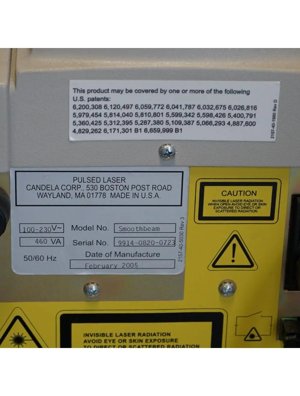 2005 Candela SmoothBeam Diode Laser Wrinkles Acne Scars Skin Lesions Portable