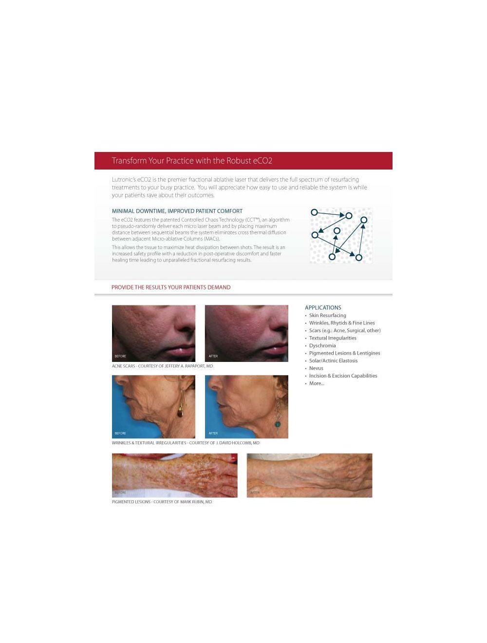 2008 Lutronic Surgical CO2 Laser eC02 Mosaic Skin Fractional Wrinkle Scar Lesion